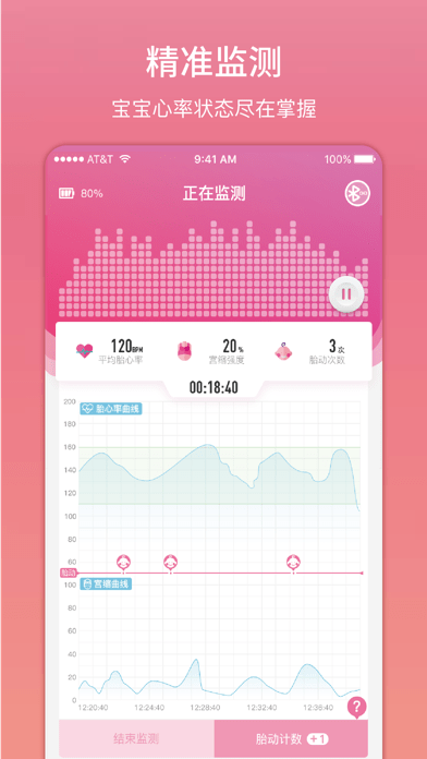 柔宝iOS