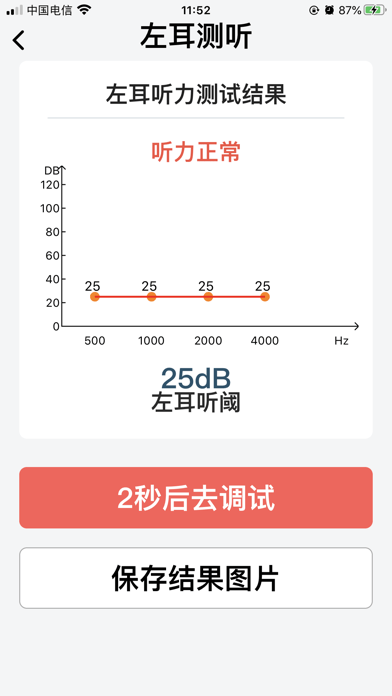 挚听iOS