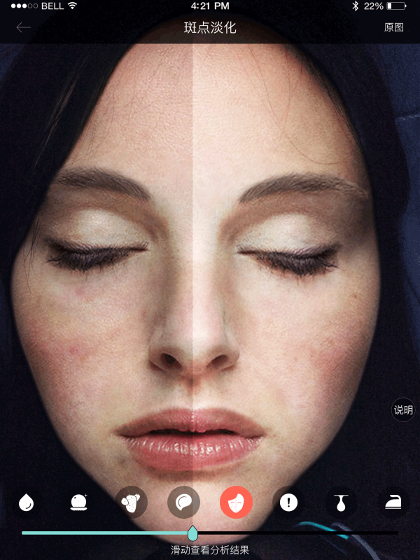 皮肤8D检测 皮肤8D检测