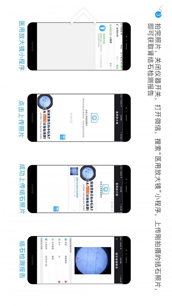 医用放大镜
