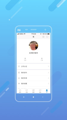 新微创源