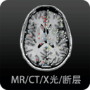 影像学图谱